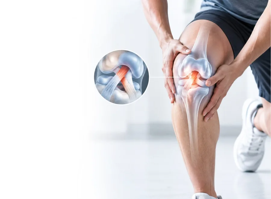 Knee joint with the anterior cruciate ligament shown in an inset illustration