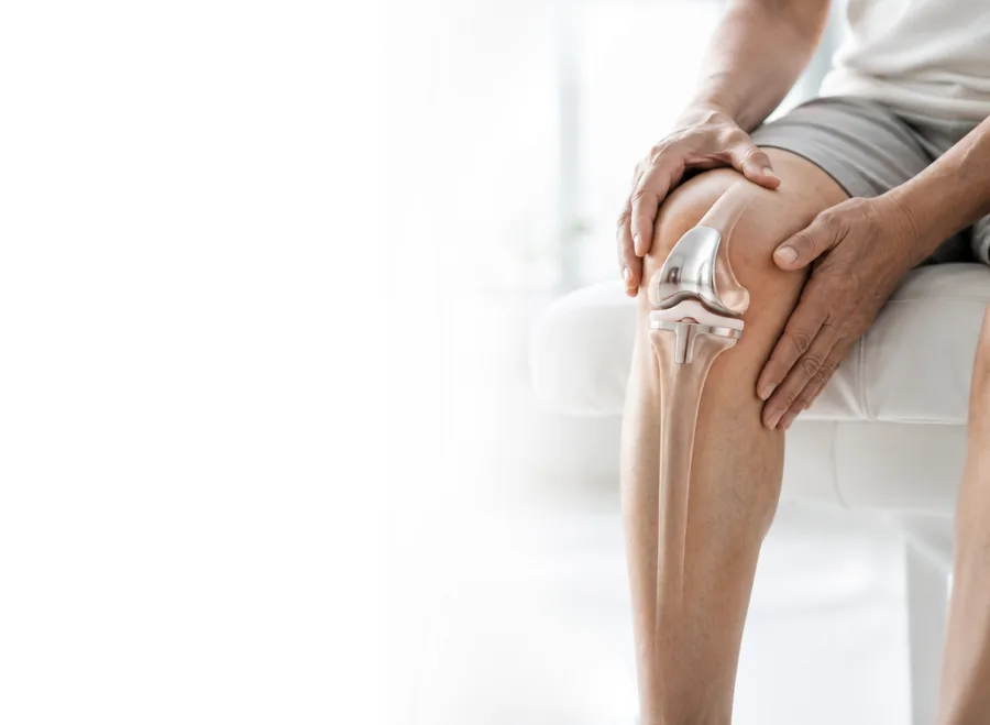 Knee with a joint replacement implant shown in place beneath the skin