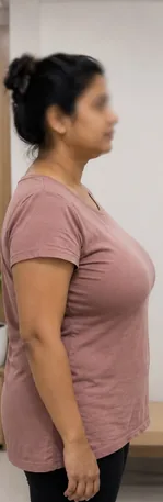Before — Meena K.