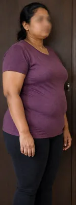 Before — Divya P.