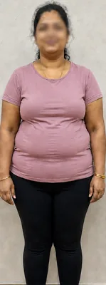 Before — Anjali R.