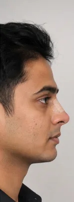 After — Arjun K.