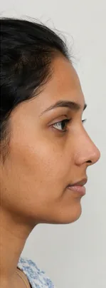 After — Priya S.