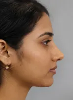 After — Kavya R.