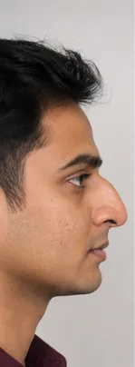 Before — Arjun K.