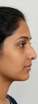 Before — Priya S.