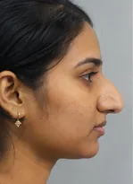 Before — Kavya R.